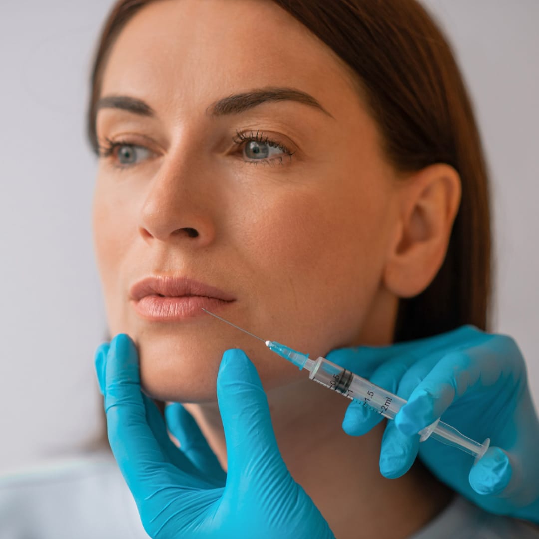 Facial Fillers with Juvederm Restylane